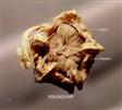  Pseudocarp-Utricle enclosed by and connate with perianth